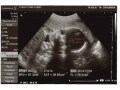 妊娠27週目エコー写真で見る胎児の体重や大きさ・早産になったら