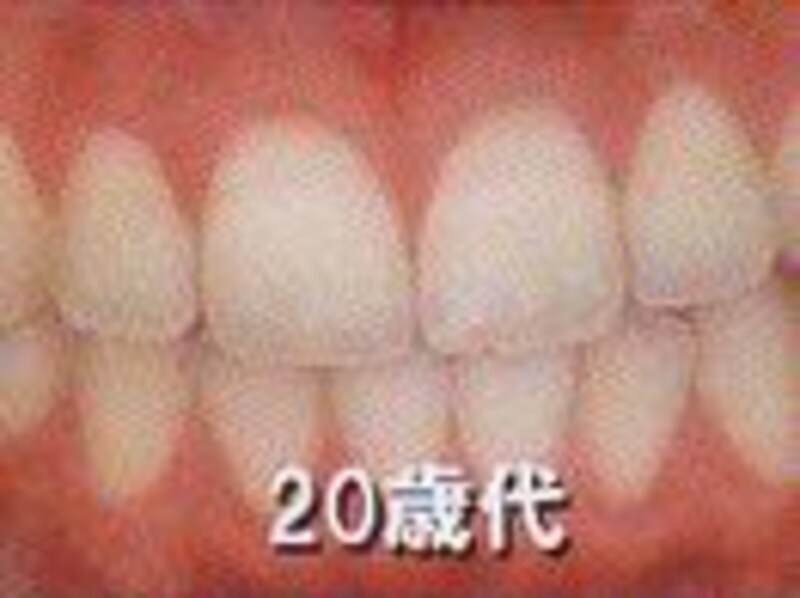 画像の代替テキスト