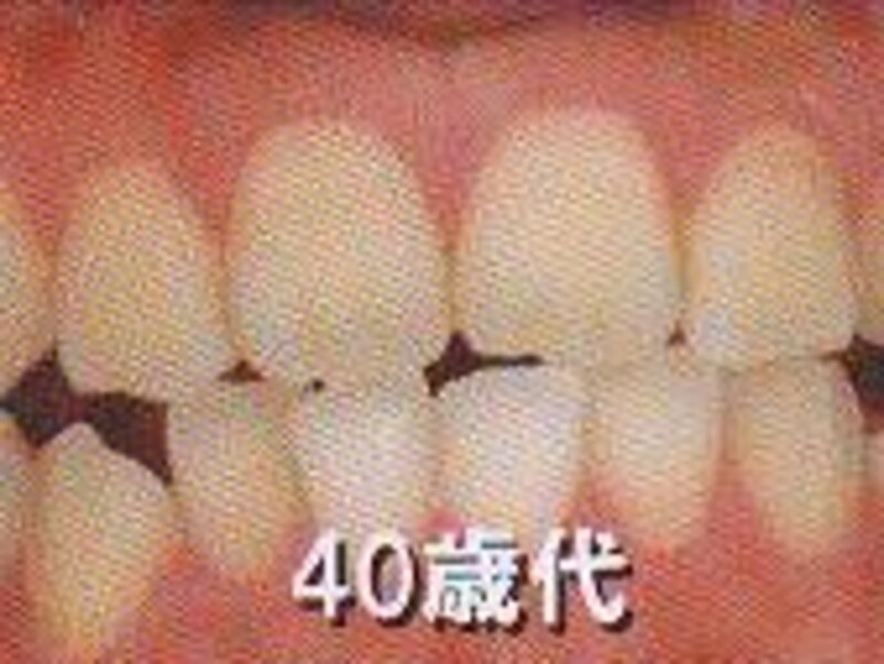 画像の代替テキスト