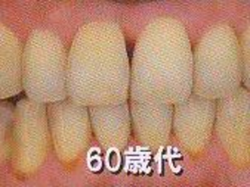 画像の代替テキスト