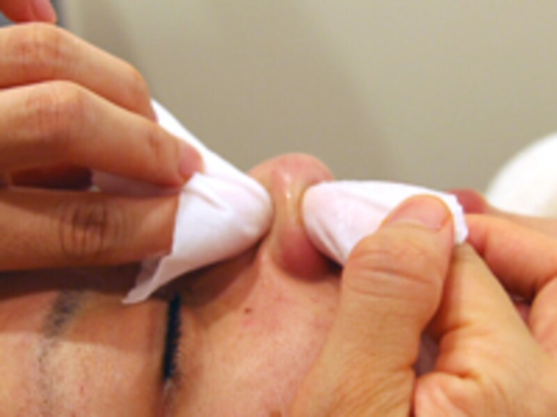 エクストラクション