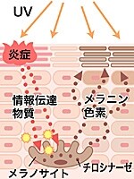 UVBは肌を火傷のような状態にする。UVBから肌を守るためにメラニン色素が活発に働いて肌色を黒くさせて紫外線をブロックする