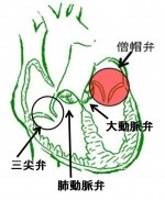 心臓の4つの弁を示します。健康な弁はやわらかくしなやかで長持ちします。昔レオナルドダビンチも感銘し研究した絶妙の構造をもちます