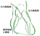 バイパス手術は冠動脈の病変を治すのではなく冠動脈全体を治すため、長期の安定性に優れます