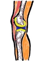 赤の筋肉・腱の硬さにより黄の関節軟骨が悪影響を受けることがあります