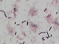 その名の通り、連鎖した形をしている溶連菌。子供の咽頭炎だけでなくさまざまな病気を引き起こします。