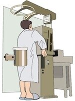 胃がんの検査は胃カメラが非常に有効ですが、粘膜の下を這っていくスキルス胃がんには胃全体の形や動きが見られるバリウム検査も有効です。
