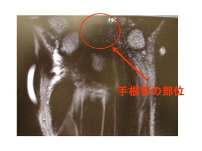 MRI