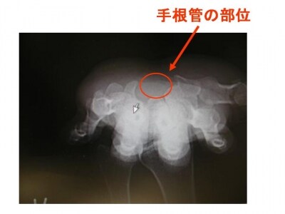 手根骨X線