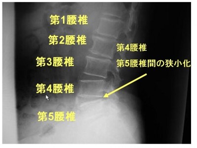 単純X線