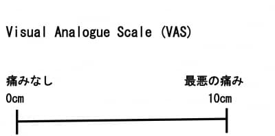 VAS,Visual analogue scale,痛み評価方法、癌の痛み