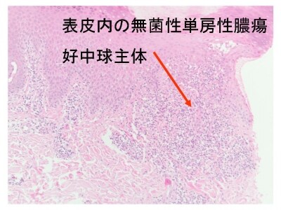 顕微鏡写真