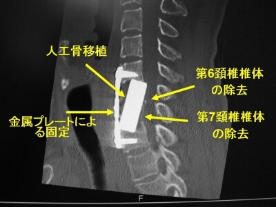 手術後。