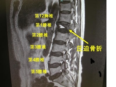 MRI