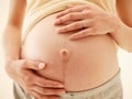 妊娠線ができる仕組みと予防6か条
