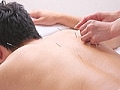 男のツボを刺激する美容鍼灸を体験！