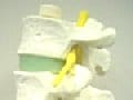 腰部脊柱管狭窄症、腰痛・足の痛みの原因
