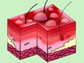 危険！ カイロ・床暖房で起きる低温火傷