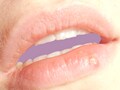 Herpes is helpless？ ヘルペスの特徴