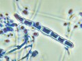 水虫の基礎知識 皮膚 爪 髪の病気 All About 水虫の基礎知識 皮膚 爪 髪の病気 All About