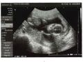 妊娠16週 赤ちゃんの性別が分かる人も！胎児の大きさ・エコー写真