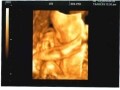 妊娠23週目エコー写真・胎動の様子・胎児の大きさや体重
