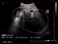 妊娠40週目 エコー写真・胎児の大きさ・妊婦の注意点