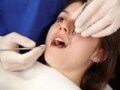 いつかは外れる？ 虫歯治療後の被せ物・詰め物の寿命