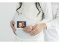 逆子の帝王切開はいつ決まる？手術の確率・自然分娩は無理？