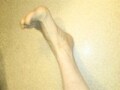 ふくらはぎチェックで腰の負担を予測！