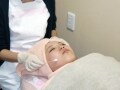 春から始める！ 初めてのメディカルピーリング