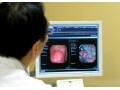 大腸ポリープと言われたら…原因・切除適応・予防法