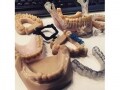 歯科業界でも注目の的「3Dプリンター」