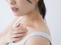 【症例写真あり】蕁麻疹の症状・治療法…疲れやストレスが原因のことも