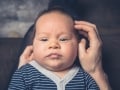 【症例画像あり】頭皮や顔にできる脂漏性皮膚炎…皮膚科での治療法