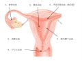妊娠初期の出血、着床出血や排卵出血などと流産の違い