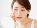 Q. 「ストレスでシミが増える」って本当ですか？