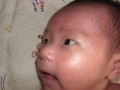 赤ちゃんの目やにの原因と対処法