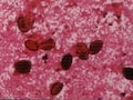 花粉対策には波動を整えて！