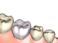 気になる歯の形…歯の奇形はトラブルの元？