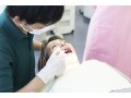 シーラントは大人にも効果的？歯の溝を埋めて虫歯予防