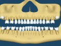 「歯の弱点？」虫歯ぐせの歯を見極める方法