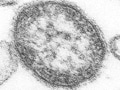 大流行の麻疹（はしか）の予防は可能か