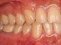 歯茎や粘膜の出血・腫れに潜む病気