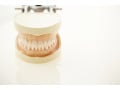 歯根破折（しこんはせつ）の症状・治療法…歯茎の激痛、腫れなど