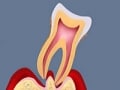 歯周病の基礎知識