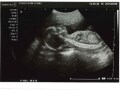 妊娠21週目エコー写真・胎動の様子・胎児の大きさや体重・性別