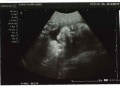 妊娠29週目 逆子は治る？エコー写真で見る胎児の大きさ・体重