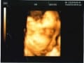 妊娠33週目 胎児の体重や大きさ・エコー写真・逆子は治る？