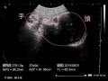 妊娠37週目 胎児の体重や大きさ・エコー写真・正期産へ